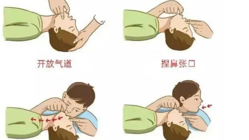 C:\Users\Administrator\Desktop\02 门诊部-当火灾遇上心脏骤停,看医护人员如何为患者建起“生命防火墙”\图片\05科普时间\04人工呼吸.png C:\Users\Administrator\Desktop\02 门诊部-当火灾遇上心脏骤停,看医护人员如何为患者建起“生命防火墙”\图片\05科普时间\04人工呼吸.png